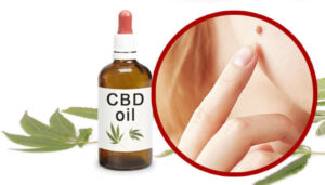 Can You Use CBD Oil for OCD?